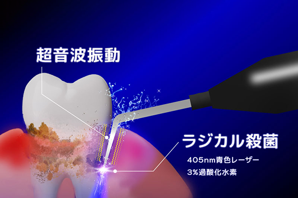 超音波振動とラジカル殺菌のイメージ